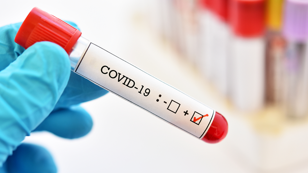 coronavirus-test-covid-19-ni9ach21